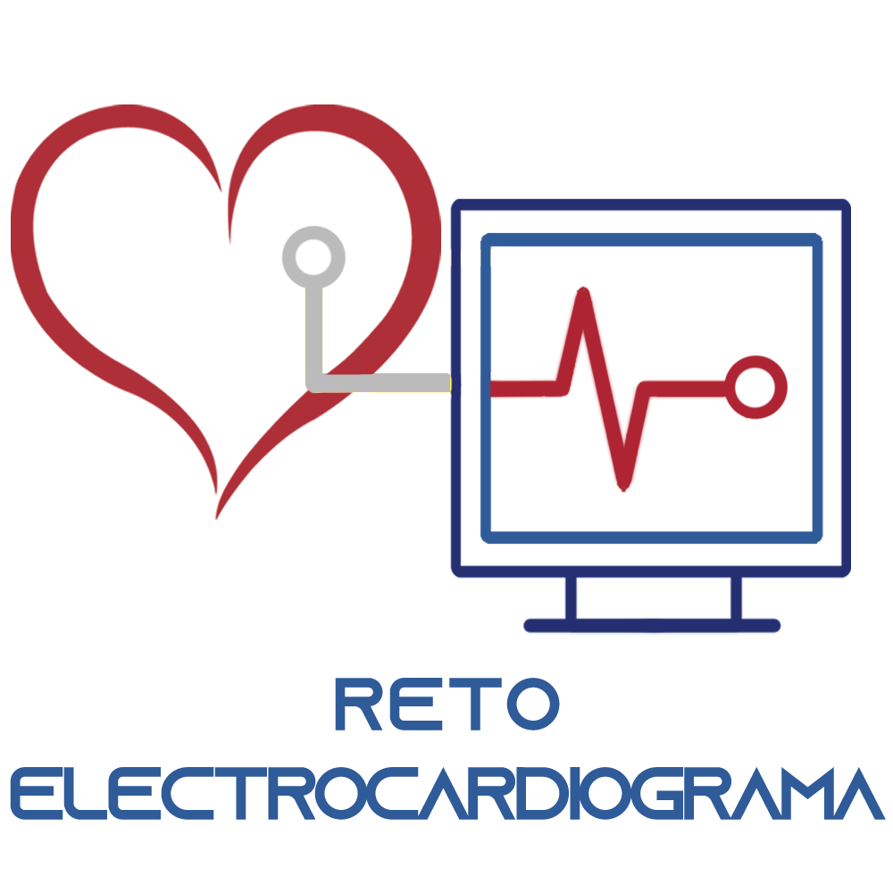 Reto Electrocardiograma